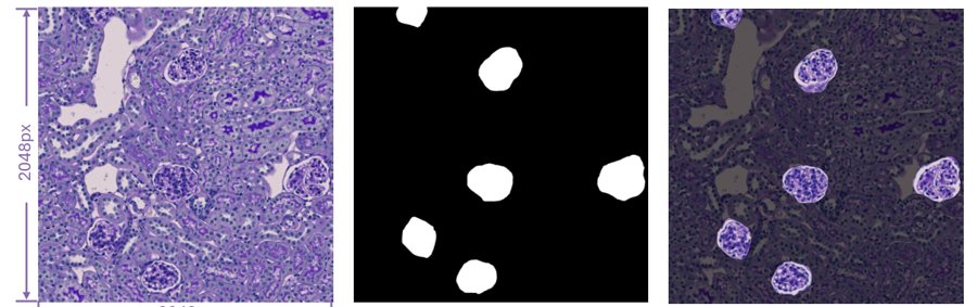 KPIs 2024 patch-level glomeruli: PAS image, ground-truth mask and overlay