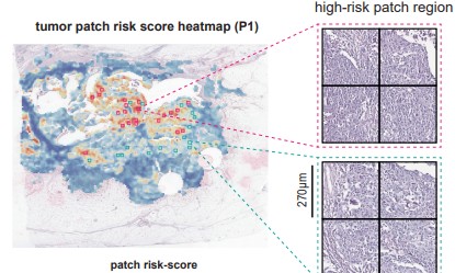 Tumor patch risk-score heatmap with high- and low-risk patch regions