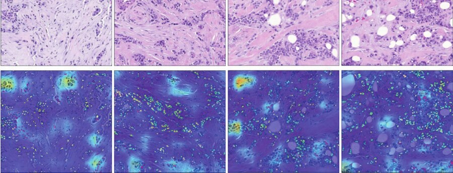 Grad-CAM over H&E for protein-receptor status prediction